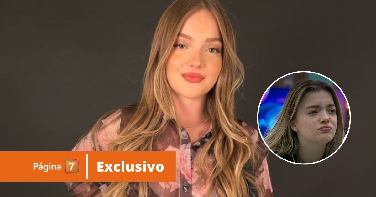 Antonia Casanova responde al bullying por sus espinillas: 
