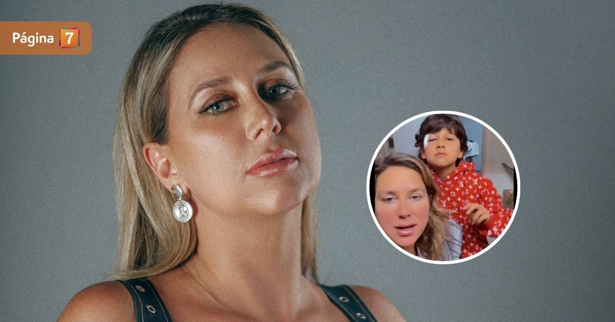 Flaviana Seeling preocupó a sus fans tras revelar accidente de su hijo: “Le pusieron muchos puntos”