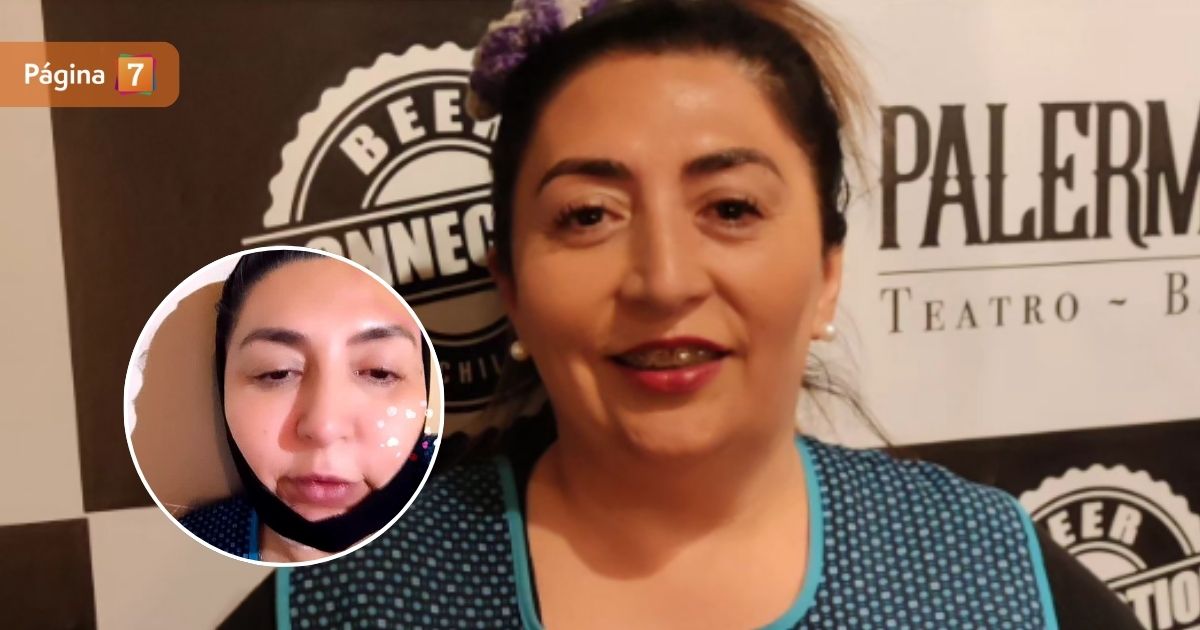 Pincoya sorprendió al anunciar que se sometió a radical cirugía estética: “Me hice un merequetengue”