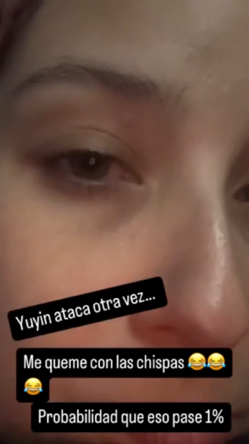 María José Quintanilla y su doloroso percance en show de Fiestas Patrias: publicó registro