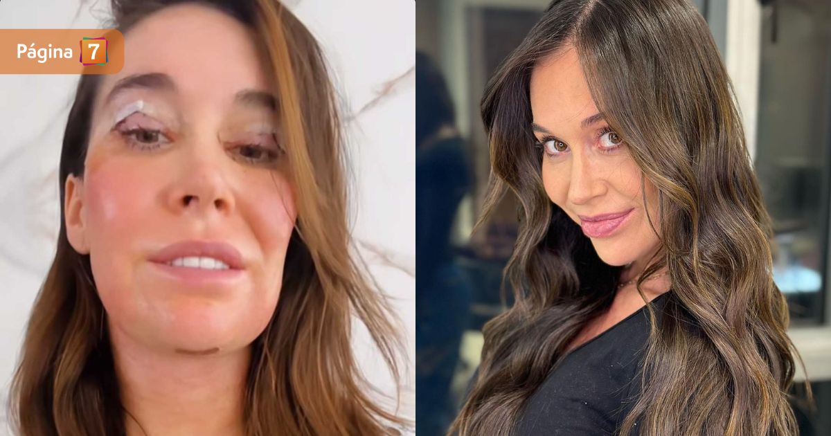 Vale Roth reveló el invasivo retoque estético que se realizó en el rostro: 