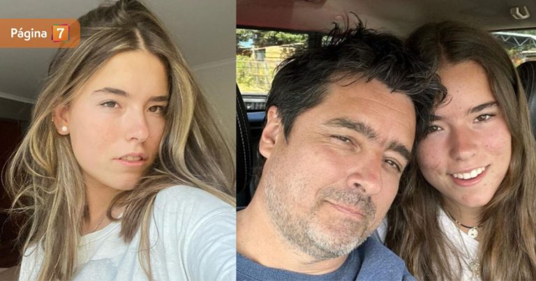 Milagros Zabaleta mostró procedimiento estético para combatir su acné: “Intenté de todo”