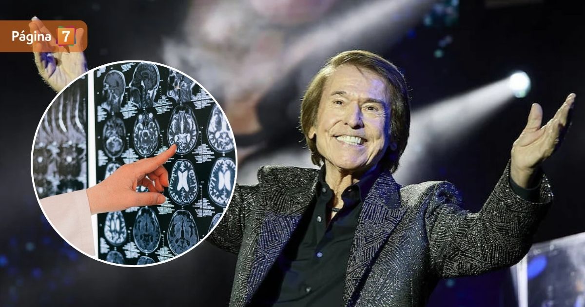 Tras diagnóstico de Raphael: ¿qué es el linfoma cerebral primario?