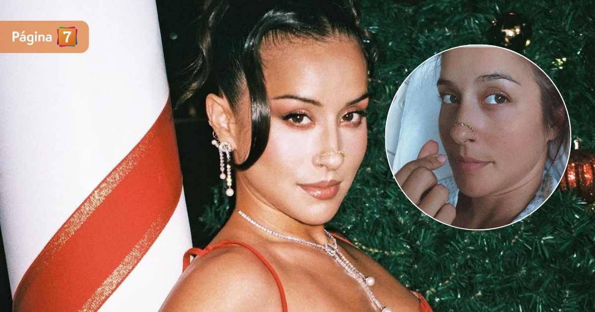 Denise Rosenthal preocupó en redes al subir foto desde clínica: cantante explicó problema de salud