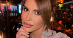 Año nuevo, labios nuevos Gala Caldirola se sometió a un procedimiento estético