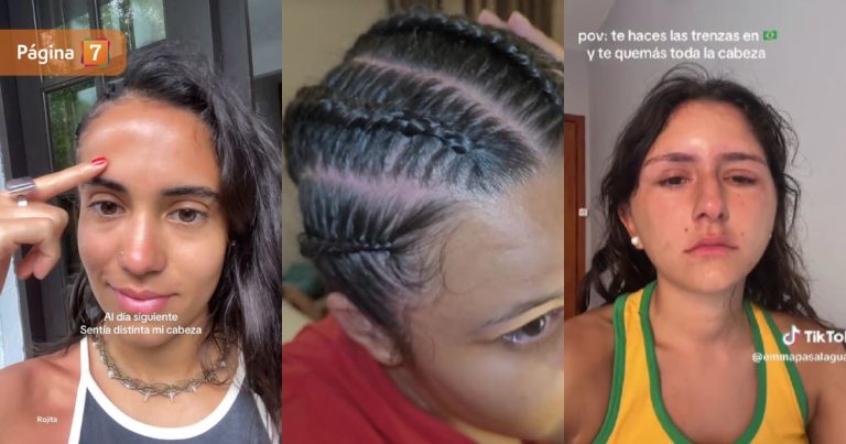 Peinado caribeño: especialista advierte los peligros de hacerse trenzas en todo el cabello