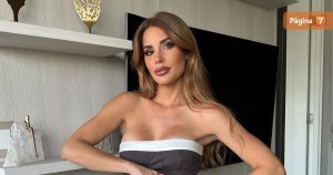 Gala Caldirola mostró radical antes y después de retoque estético: "Tenía los labios como salchicha"