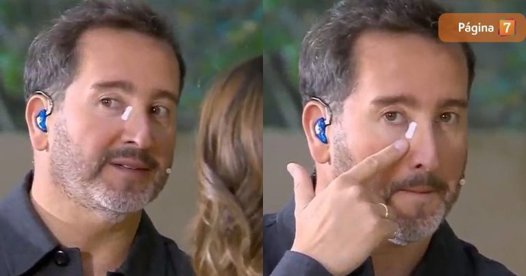 Eduardo Fuentes debió someterse a cirugía por carcinoma: 