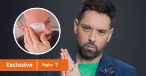 Afección por uso de lentes de contacto dejó a Michael Roldán con parche en un ojo: "Hago mea culpa"