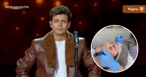 El tratamiento facial del imitador de Luis Miguel en Mi Nombre Es