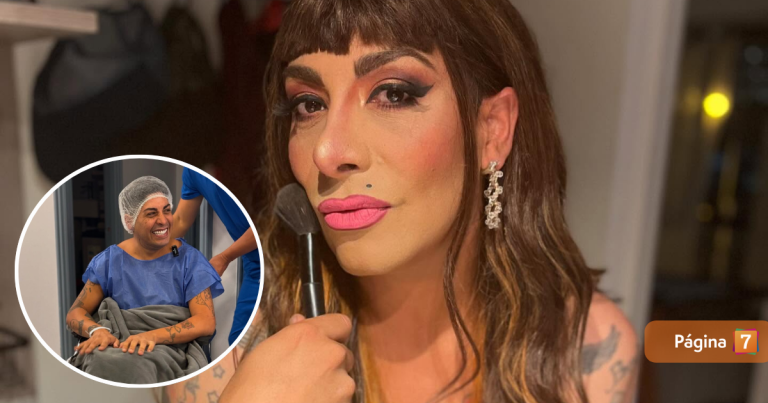 ¿Sigue el misterio? Botota Fox reveló nuevas imágenes sobre su cirugía estética