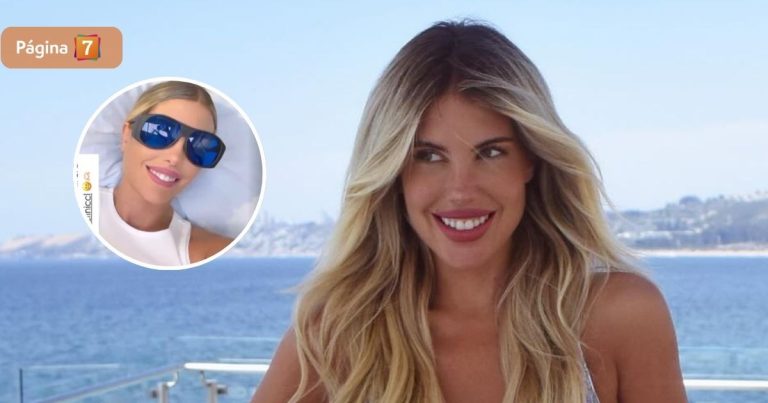 Coté López mostró procedimiento estético al que se sometió: “No duele nada mi gente”