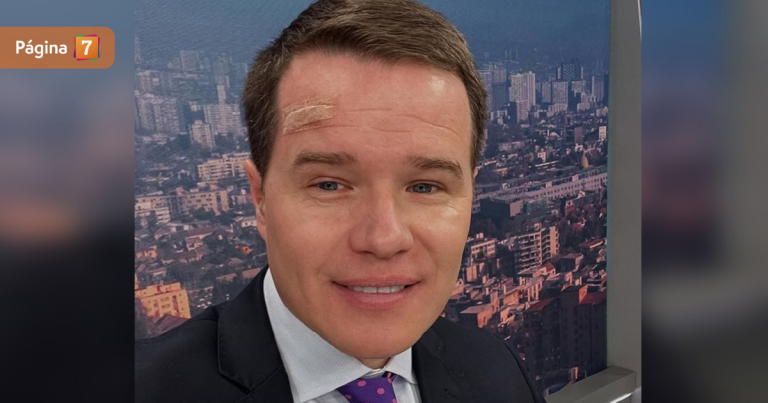 Davor Gjuranovic tras operarse de cáncer a la piel: 