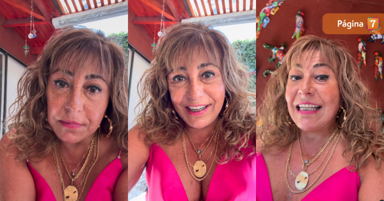 Tras el lifting facial: Helhue Sukni mostró nuevo retoque estético que se hizo en el rostro