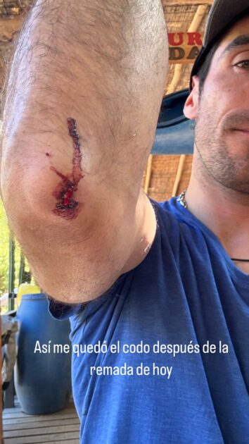 Pedro Astorga participará en importante competencia: mostró dolorosa imagen tras su entrenamiento