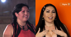 Camila Arismendi se hizo cirugía en el rostro