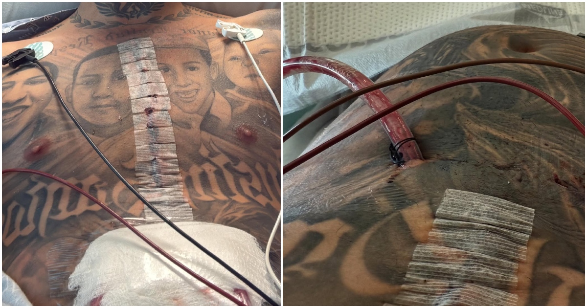 Operan del corazón a Arcángel