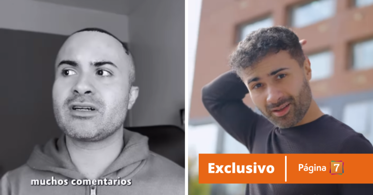 Marcelo Alcázar y por qué se hizo un implante de pelo: recordó episodio que lo hizo sufrir