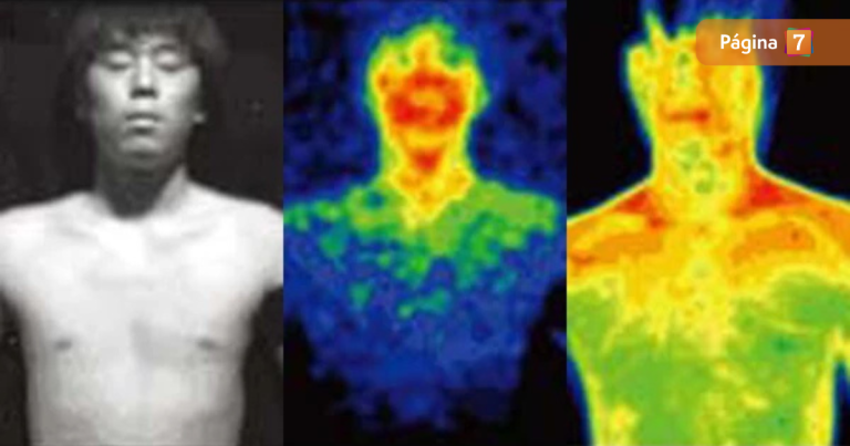 ¿Sabías que la luz que emite la piel se apaga tras la muerte?: esto es lo que señala la ciencia