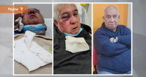 Lesiones del conserje resultaron más graves de lo esperado: agresor podría ser reformalizado