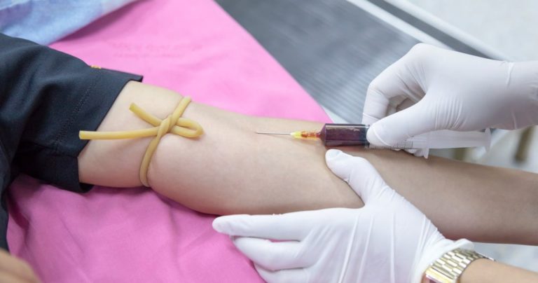 Chequeos médicos esenciales después de los 30 años: estos son los exámenes que deberías realizarte