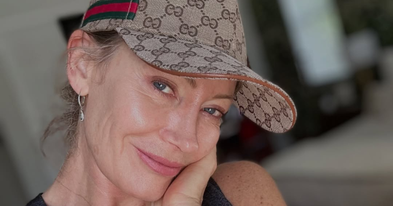 Marcela Vacarezza se sometió a innovador tratamiento estético: mostró video del procedimiento