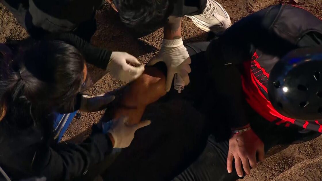 Todos contra Princeso: participante genera repudio por no competir y causar lesión de compañero