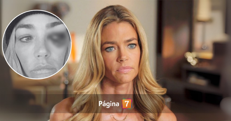 ¿Quién es Denise Richards? Actriz de 'Scary Movie 3' acusó brutales agresiones de su exesposo