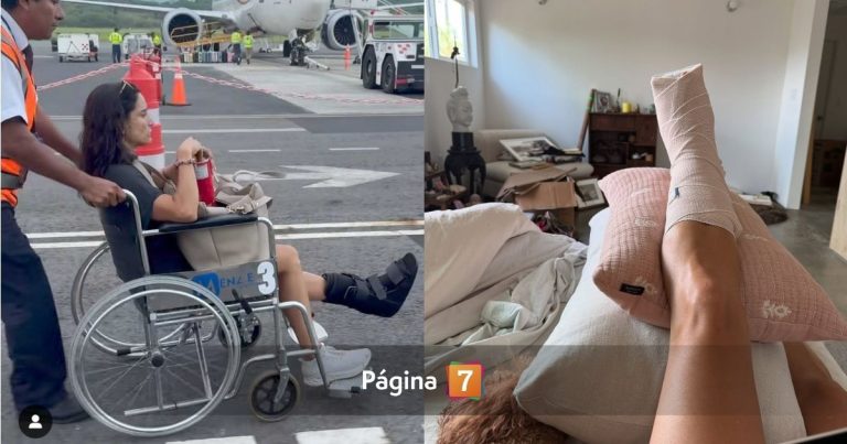 Leonor Varela mostró proceso de recuperación tras dolorosa fractura: 