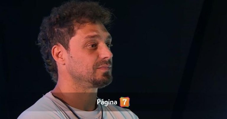 Joche Bibbó habló de delicada condición médica que sufre y recordó crudo accidente: requirió cirugía