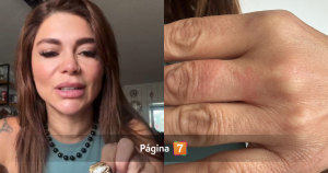 Antonella Ríos terminó en ferretería tras quedar con dedo atrapado en un anillo: "Estaba asustada"