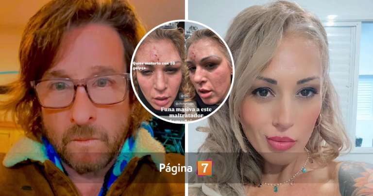 Buscan a pareja de ex Mekano Ariela Medeiros tras brutal ataque: 