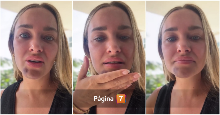 Daniela Nicolás preocupó por marcas en su cara: sufrió fuerte caída en la ducha