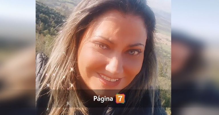 Denisse Campos contó el verdadero motivo detrás de sus múltiples intervenciones estéticas