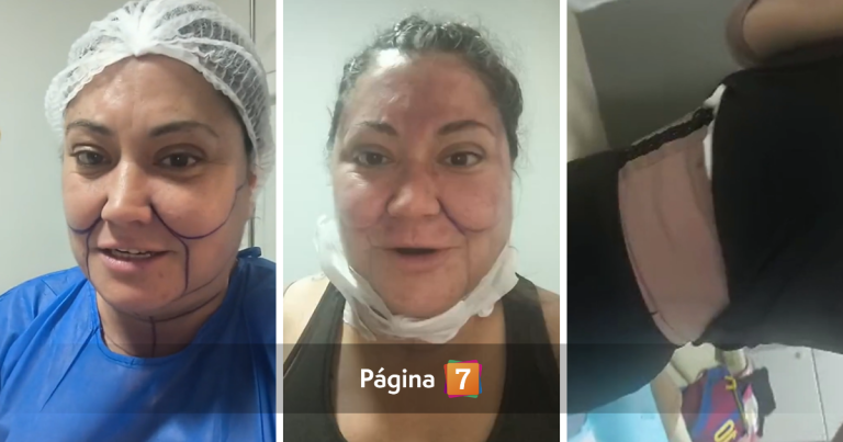 Denisse Campos se realizó intervenciones estéticas en varias partes de su cuerpo: mostró resultado