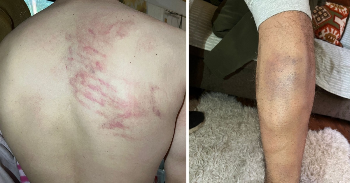 Joven con TEA denuncia agresión de Carabineros