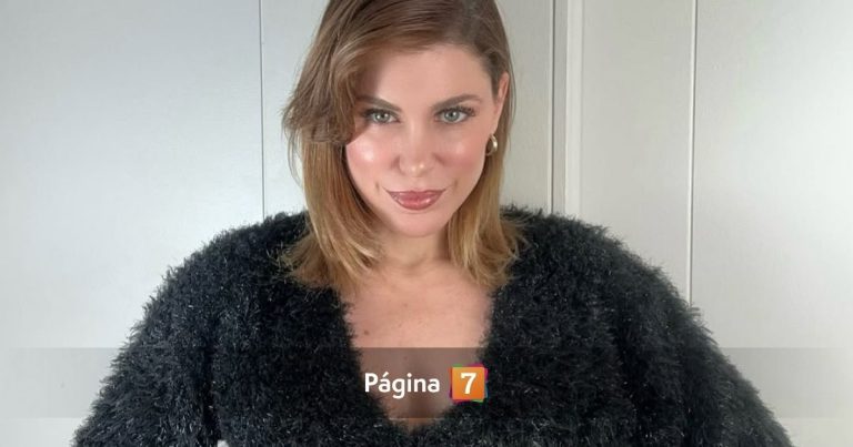 Wilma González sufrió accidente vial que la dejó con heridas: reveló cómo el casco le salvó la vida