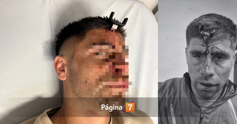 Brutal ataque a futbolista argentino: le clavaron una llave en la cabeza y le fracturaron el cráneo