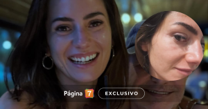 Rosario Bravo apostó por revolucionario tratamiento estético que popularizaron las Kardashian