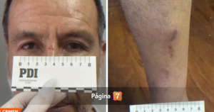 Revelan inéditos registros de las lesiones que tenía Jorge Ugalde al momento de su detención