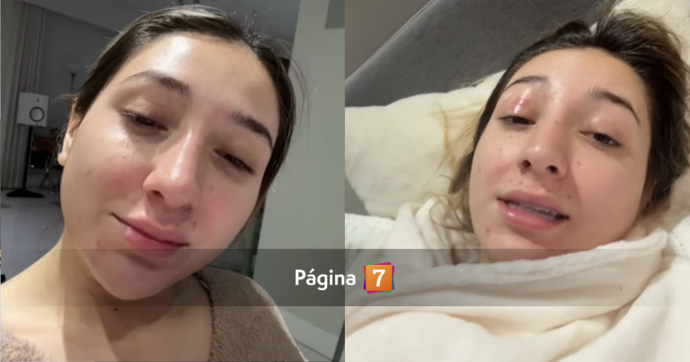 Carlita Inostroza impacta tras mostrar el antes y después de su cirugía estética: 