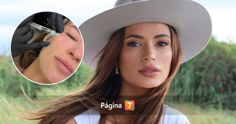Critican a Julia Fernandes por mostrar resultados de intervención estética con 