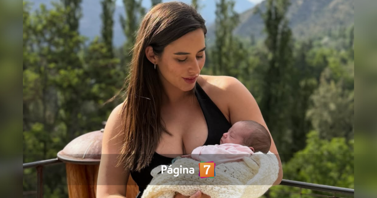 Melina Noto mostró el antes y después de su piel gracias a tratamiento posterior a embarazo