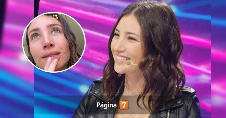 Ex 'Gran Hermano' Maite Phillips expuso inseguridad por estado de su rostro: 